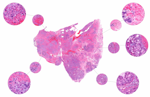 Example H&E Image
